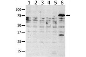 Image no. 2 for anti-P21-Activated Kinase 6 (PAK6) (AA 116-146) antibody (ABIN3032122)