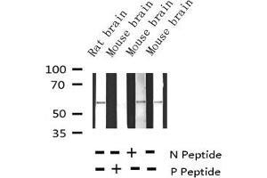 Image no. 4 for anti-Tyrosine Hydroxylase (TH) (pSer31) antibody (ABIN6255191)