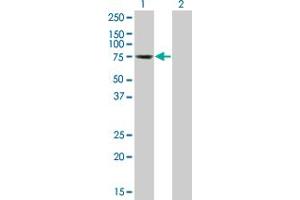 Image no. 3 for anti-Testis-Specific Kinase 2 (TESK2) (AA 405-542) antibody (ABIN564528)