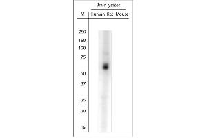 Image no. 1 for anti-Solute Carrier Family 17 (Sodium-Dependent Inorganic Phosphate Cotransporter), Member 8 (SLC17A8) (C-Term) antibody (ABIN351385)