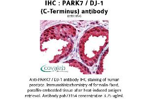 Image no. 2 for anti-Parkinson Protein 7 (PARK7) (C-Term) antibody (ABIN1737866)