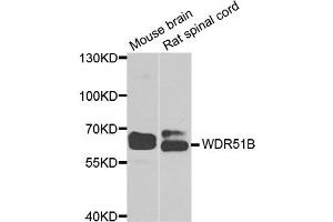 Image no. 1 for anti-POC1 Centriolar Protein Homolog B (POC1B) antibody (ABIN2560765)