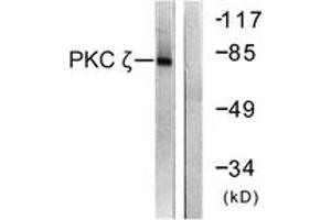 Image no. 1 for anti-Protein Kinase C, zeta (PRKCZ) (AA 526-575) antibody (ABIN1532525)
