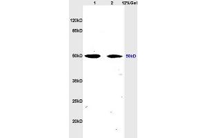 Image no. 2 for anti-Tubulin, beta (TUBB) (AA 61-160) antibody (ABIN706721)