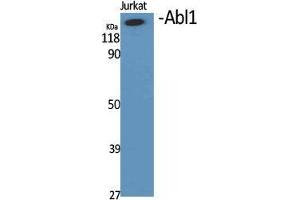 Image no. 2 for anti-C-Abl Oncogene 1, Non-Receptor tyrosine Kinase (ABL1) (Ser12) antibody (ABIN3183602)