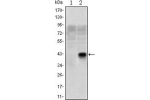 Image no. 3 for anti-Oligodendrocyte Lineage Transcription Factor 2 (OLIG2) antibody (ABIN1108515)