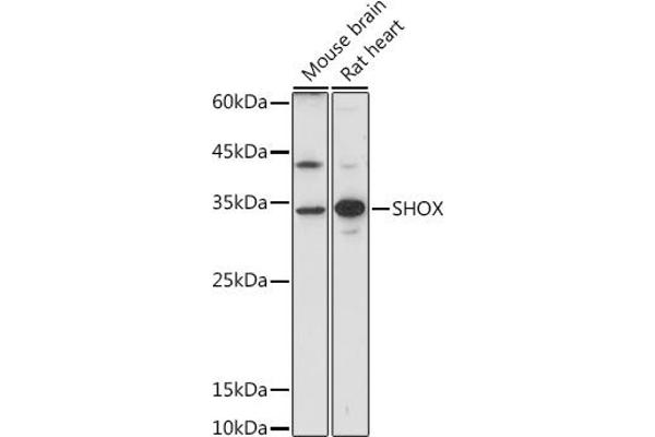 SHOX antibody