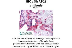 Image no. 3 for anti-Synaptosomal-Associated Protein, 23kDa (SNAP23) (AA 1-132) antibody (ABIN1739474)