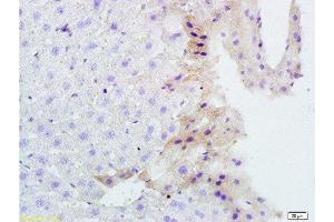 Image no. 4 for anti-Tumor Necrosis Factor (Ligand) Superfamily, Member 14 (TNFSF14) (AA 141-240) antibody (ABIN740625)