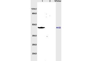 Image no. 2 for anti-Sex Hormone Binding Globulin (SHBG) (AA 51-150) antibody (ABIN739860)