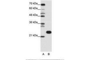 Image no. 1 for anti-Ribosomal Protein L13 (RPL13) (C-Term) antibody (ABIN6736166)