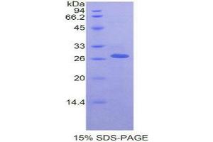 Image no. 1 for Receptor-Interacting serine-threonine Kinase 3 (RIPK3) (AA 50-272) protein (His tag) (ABIN1878520)