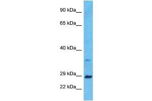 Image no. 6 for anti-Brain-Derived Neurotrophic Factor (BDNF) (Middle Region) antibody (ABIN2777093)