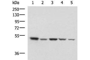 Western blot analysis of HepG2 NIH/3T3 C2CL2 Raji and Jurkat cell lysates using ENO3 Polyclonal Antibody at dilution of 1:1000