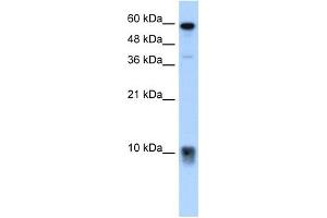 Image no. 2 for anti-S100 Calcium Binding Protein A3 (S100A3) (N-Term) antibody (ABIN629669)