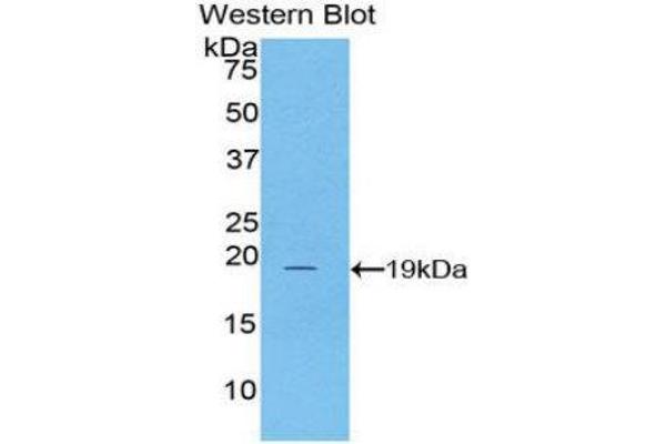anti-Adrenoceptor alpha 1A (ADRA1A) (AA 330-466) antibody