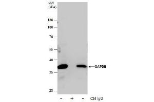Image no. 6 for anti-Glyceraldehyde-3-Phosphate Dehydrogenase (GAPDH) (Center) antibody (ABIN2857072)