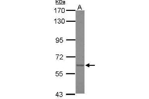 Image no. 1 for anti-Asparagine Synthetase (ASNS) (Center) antibody (ABIN2854439)
