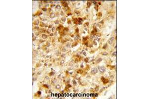 Image no. 2 for anti-Peroxisomal Biogenesis Factor 2 (PEX2) (AA 165-194) antibody (ABIN5538088)