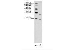 Image no. 1 for anti-Deoxyribonuclease II beta (DNASE2B) (AA 47-96) antibody (ABIN203437)