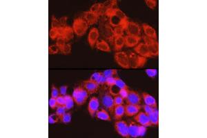 Immunofluorescence analysis of HepG2 cells using PYGL Rabbit pAb (ABIN6132277, ABIN6146525, ABIN6146526 and ABIN6222425) at dilution of 1:150 (40x lens).