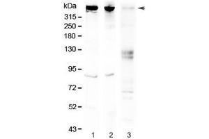 Image no. 1 for anti-Spastic Ataxia of Charlevoix-Saguenay (Sacsin) (SACS) antibody (ABIN5708501)