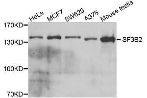 Image no. 1 for anti-Splicing Factor 3b, Subunit 2, 145kDa (SF3B2) antibody (ABIN6147666)