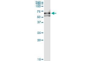Image no. 2 for anti-Vaccinia Related Kinase 2 (VRK2) (AA 1-508) antibody (ABIN950130)