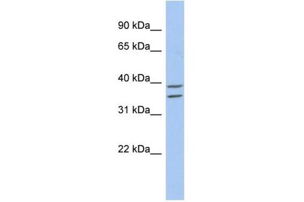 anti-Zinc Binding Alcohol Dehydrogenase Domain Containing 2 (ZADH2) (N-Term) antibody