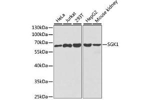 Image no. 3 for anti-serum/glucocorticoid Regulated Kinase 1 (SGK1) antibody (ABIN3021291)