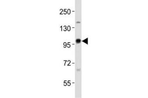 Image no. 4 for anti-Enhancer of Zeste Homolog 2 (EZH2) antibody (ABIN3030808)