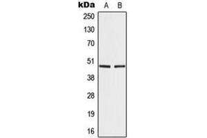 Image no. 3 for anti-Interferon Regulatory Factor 4 (IRF4) (Center) antibody (ABIN2706409)