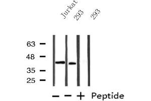 Image no. 1 for anti-UDP-Gal:betaGlcNAc beta 1,4 Galactosyltransferase, Polypeptide 1 (B4GALT1) (C-Term) antibody (ABIN6259493)