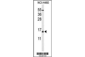 Image no. 1 for anti-KCNE1-Like (KCNE1L) (Center) antibody (ABIN2488686)