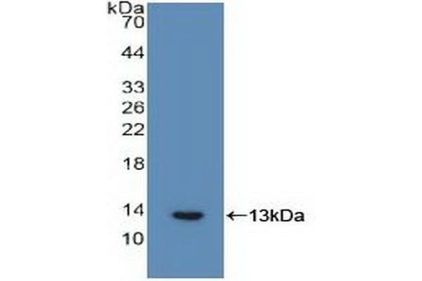 IL-6 Receptor anticorps  (AA 216-356)