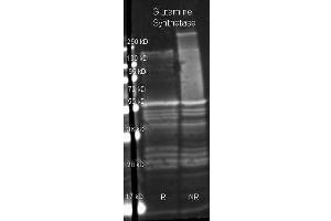 Image no. 1 for anti-Glutamine Synthetase (GLN1) antibody (HRP) (ABIN5596985)