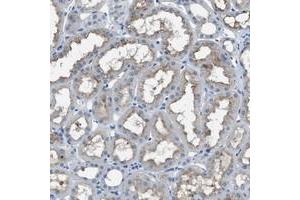 SLC38A6 antibody