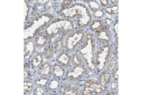 SLC38A6 antibody
