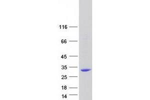 Image no. 1 for Methyltransferase Like 21C (METTL21C) protein (Myc-DYKDDDDK Tag) (ABIN2715403)