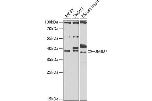 JMJD7 Antikörper  (AA 1-316)