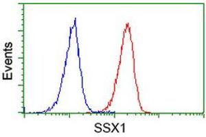 Image no. 3 for anti-Synovial Sarcoma, X Breakpoint 1 (SSX1) antibody (ABIN1501156)