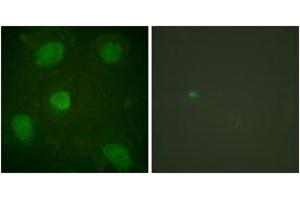 Image no. 1 for anti-Transforming Growth Factor beta 1 Induced Transcript 1 (TGFB1I1) (AA 31-80) antibody (ABIN1532675)