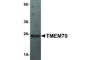 Image no. 1 for anti-Transmembrane Protein 70 (TMM70) (Internal Region) antibody (ABIN6657332)