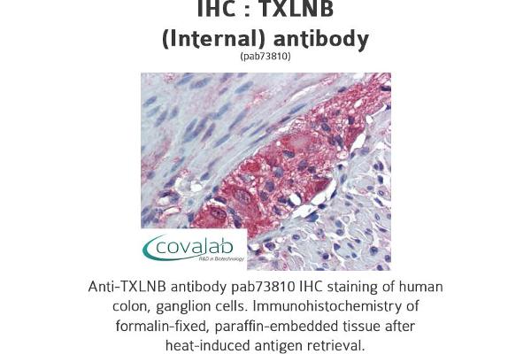 Taxilin beta antibody  (Internal Region)