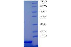 Image no. 1 for Chemokine (C-X-C Motif) Ligand 5 (CXCL5) (AA 46-117), (partial) protein (His tag) (ABIN1046746)