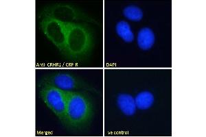 Image no. 2 for anti-Corticotropin Releasing Hormone Receptor 1 (CRHR1) (AA 250-263) antibody (ABIN190893)