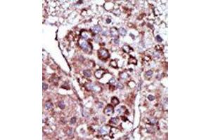 Image no. 2 for anti-Diacylglycerol Kinase, zeta (DGKZ) (C-Term) antibody (ABIN360519)