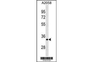 Image no. 1 for anti-ELOVL Fatty Acid Elongase 3 (ELOVL3) (AA 241-270), (C-Term) antibody (ABIN1881293)