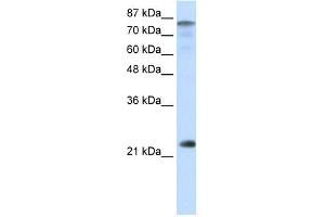 Image no. 1 for anti-Nuclear Transcription Factor Y, beta (NFYB) (N-Term) antibody (ABIN2780750)