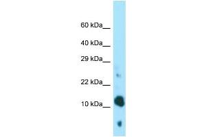 Image no. 1 for anti-Brain Expressed, X-Linked 4 (BEX4) (N-Term) antibody (ABIN2790518)